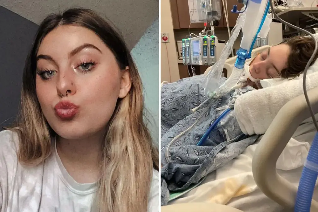 Teen goes on life support with lung damage — vaping habit to blame