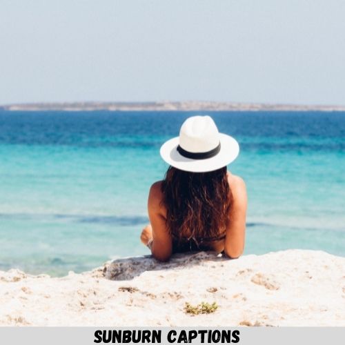 Sunburn Captions