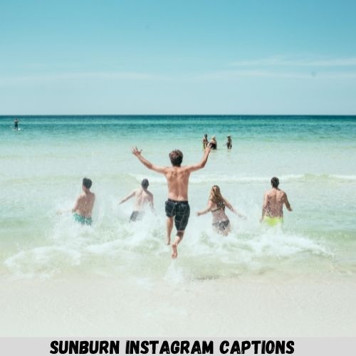 Sunburn Instagram Captions