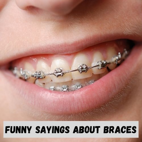Funny Sayings about Braces